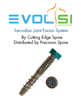 SureLOK™ Pedicle Screw System