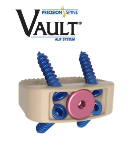 Vault™ Stand-Alone ALIF System